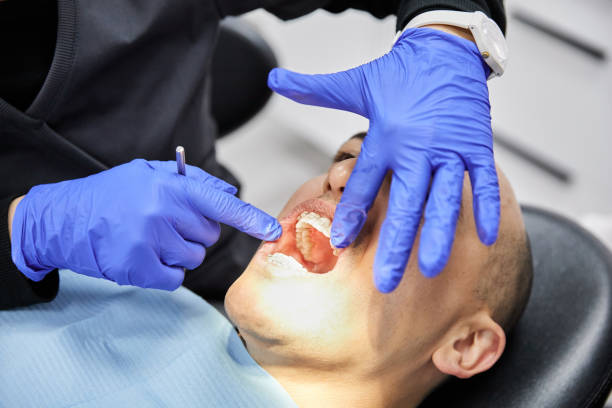 Best Same-Day Emergency Dental Services in Connerton, FL